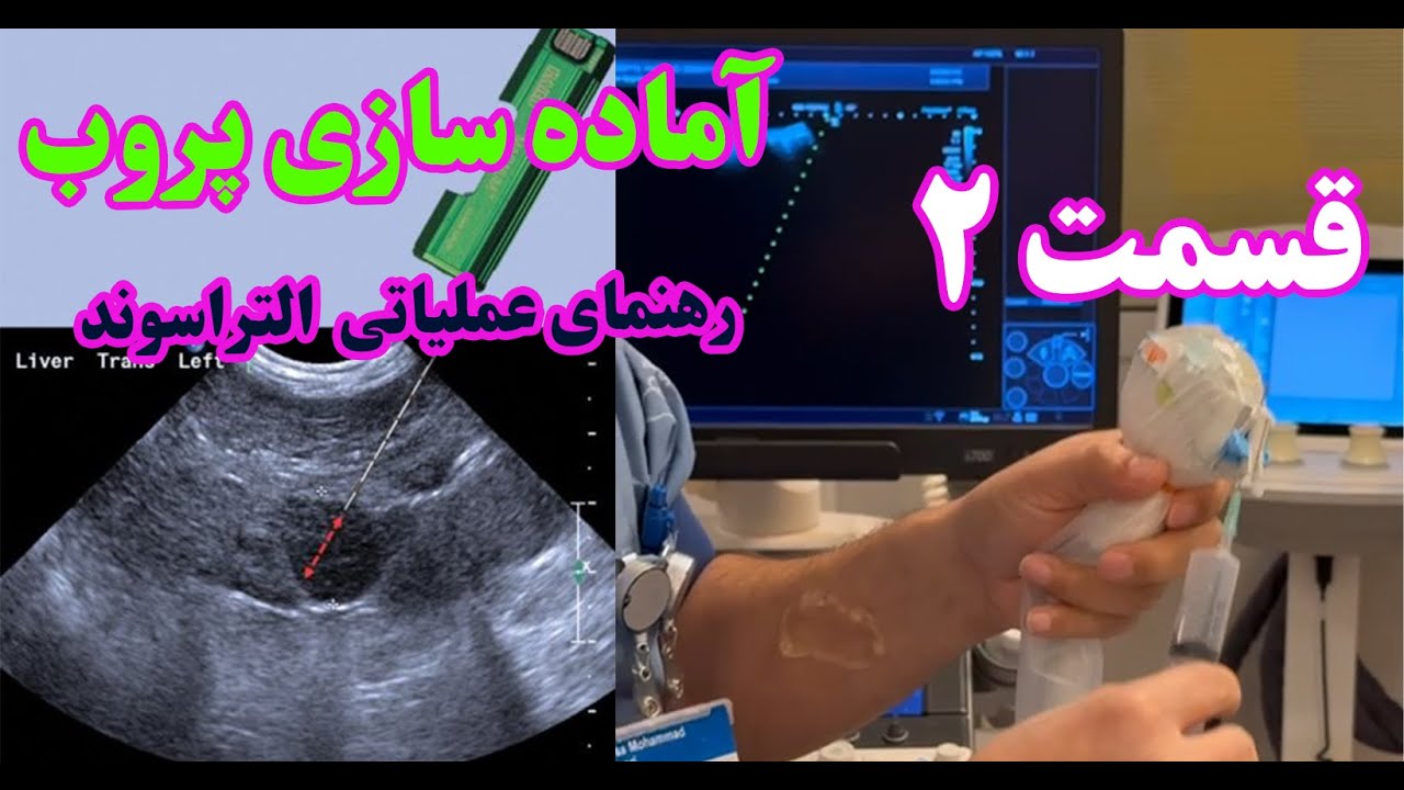 راهنمای آماده سازی پروب اولتراسوند برای بیوپسی و دریناژ | مهارت های ضروری برای داکتران افغان