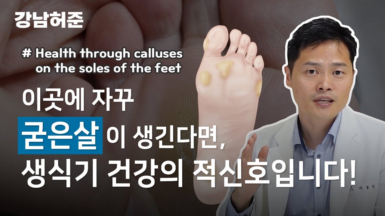 발바닥만 보고도 상대방의 건강을 알수있다?! [ 발바닥 굳은살로 보는 건강 진단법 ]