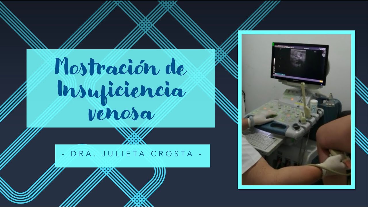 Mostración de Insuficiencia Venosa 1