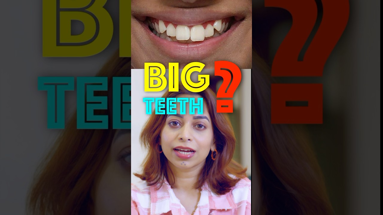 Teeth Size Reduction! #teethcontouring  #teeth #beauty #trending #shorts #viralvideo #transformation