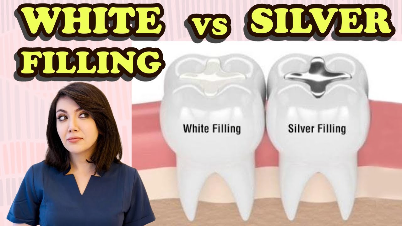 Silver vs White Fillings! Which Is Better?