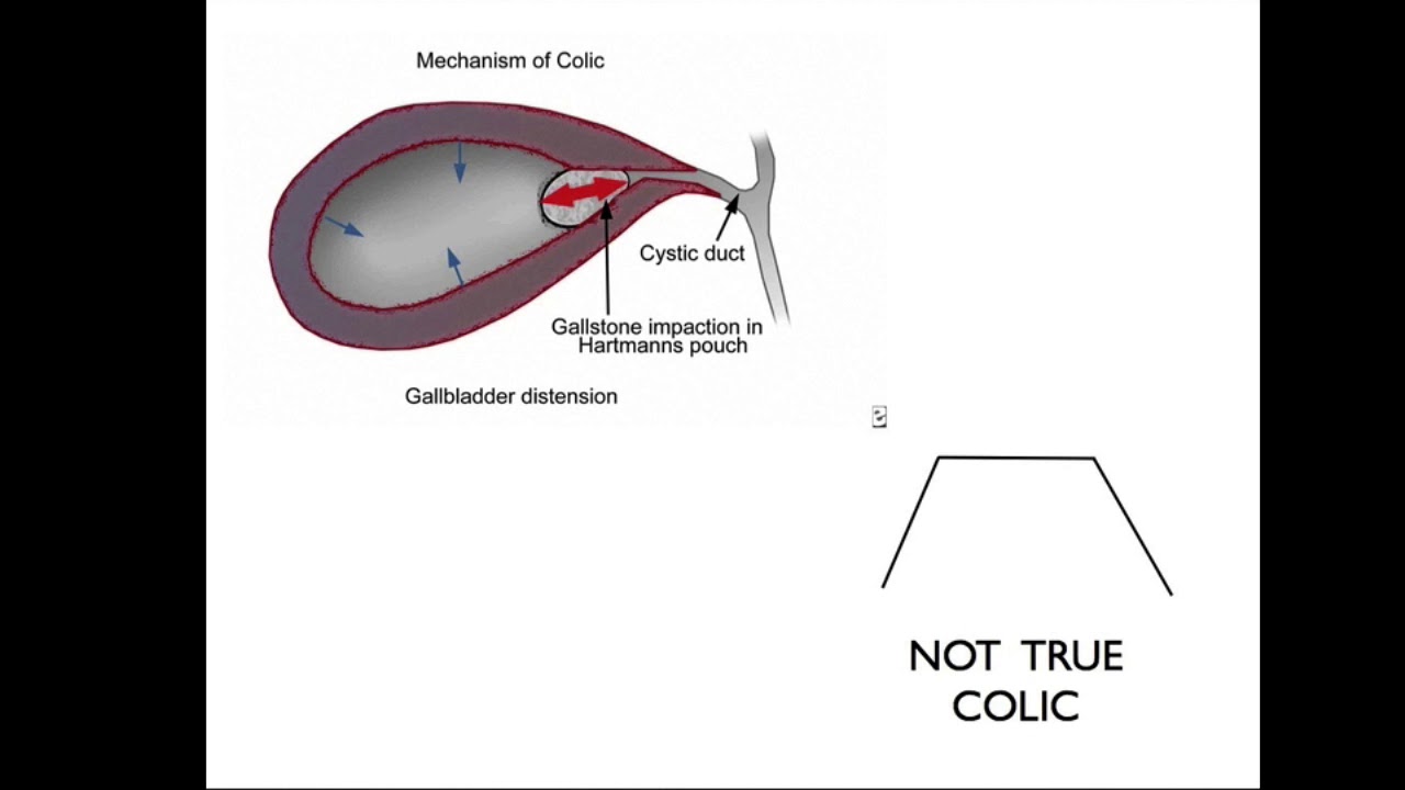 General surgery - gallbladder