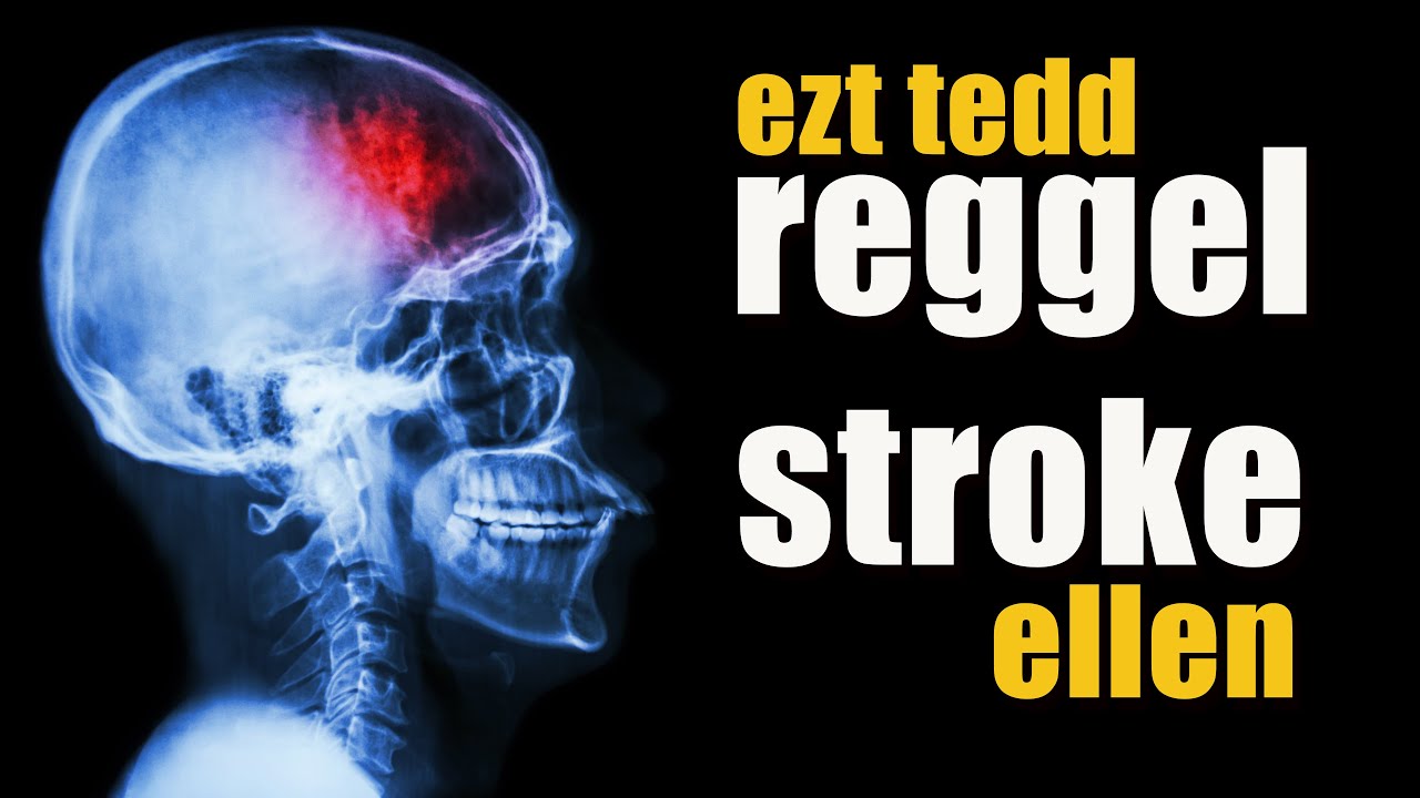 Ezzel a reggeli rutinnal megelőzhető a stroke! Tudnod kell róla.