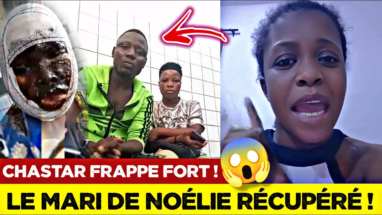 🚨CHASTAR RÉPOND AU MARI DE NOÉLIE, LA JEUNE FEMME DÉTRUITE PAR ATTAQUE À L’ACIDE🇹🇬