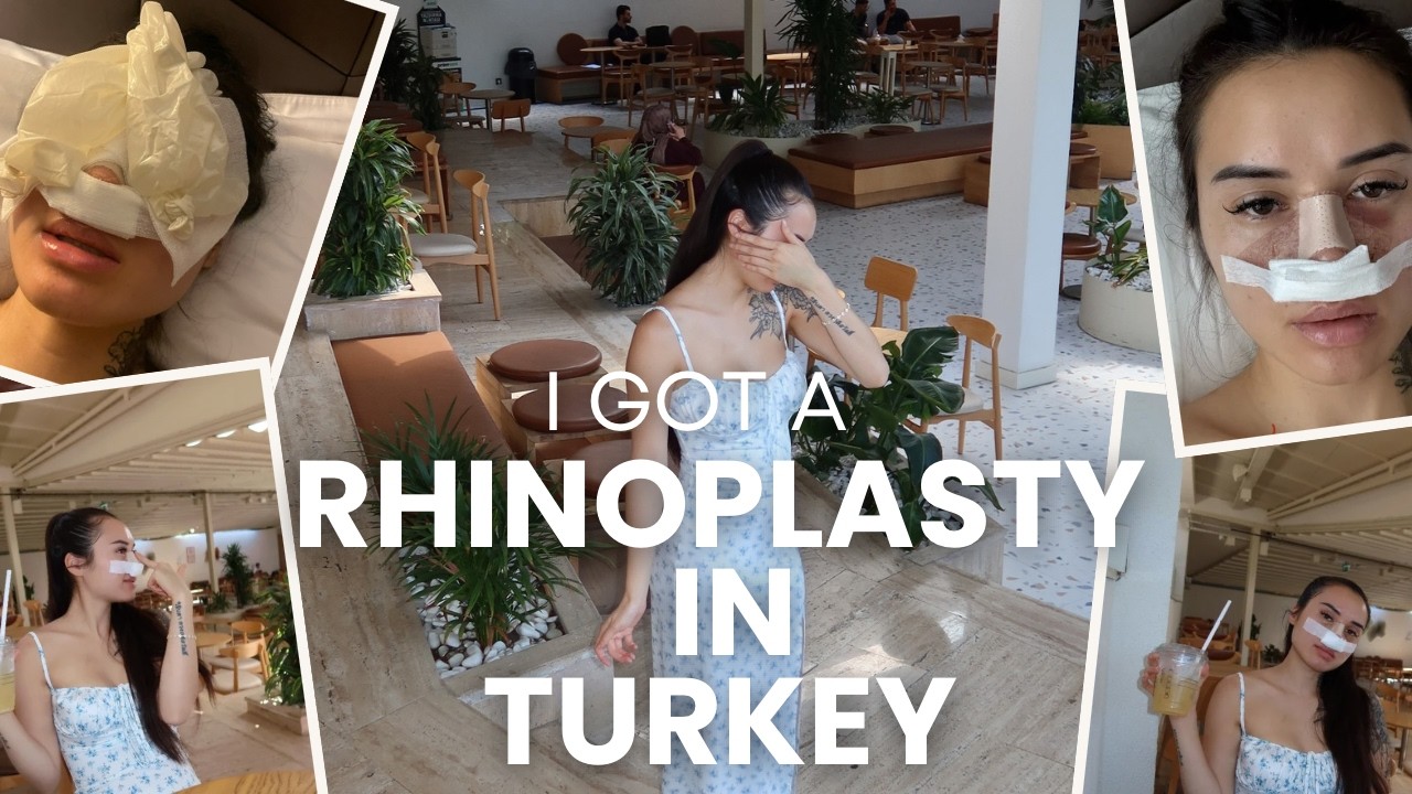 I got a rhinoplasty in TURKEY | Nose Job Vlog + An Adventure in Istanbul | Dr Sedat