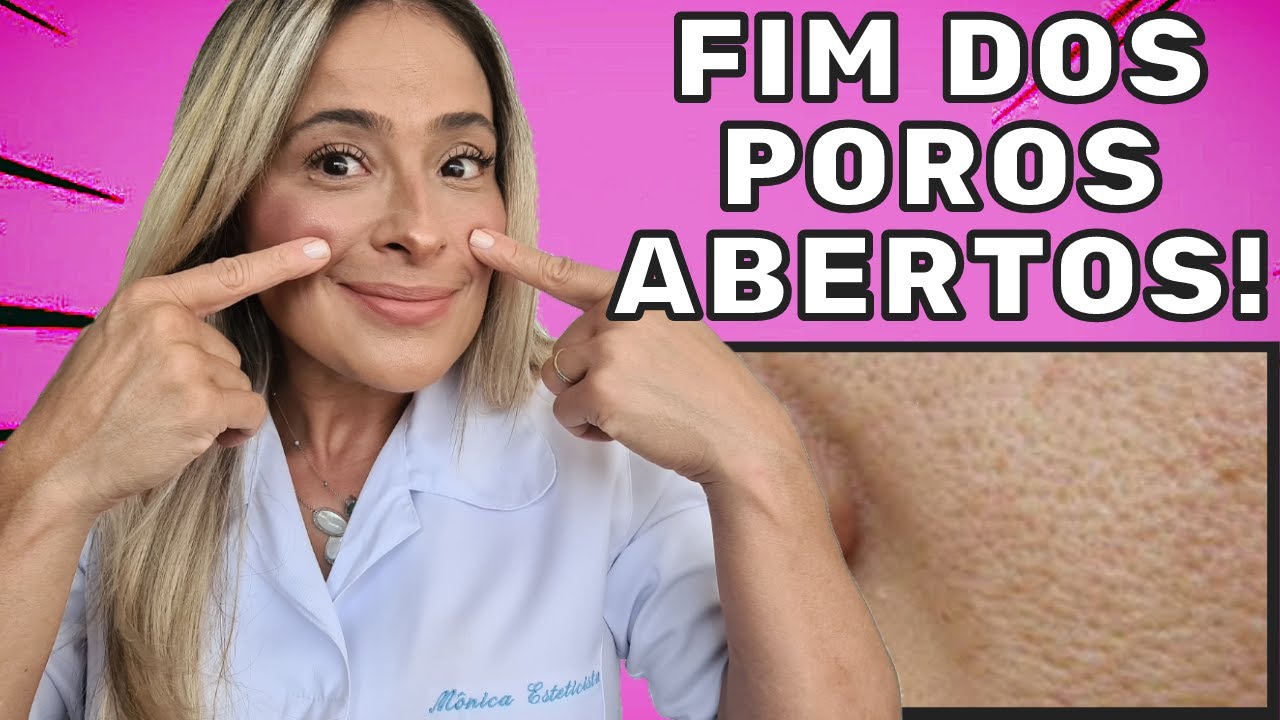 POROS ABERTOS E DILATADOS? ACABE J&Aacute; COM ESTE PROBLEMA! 02 RECEITAS CASEIRAS!