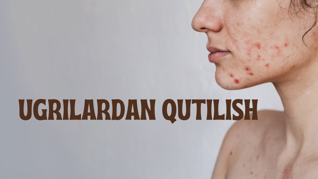 Ugrilardan qutilish | Kosmetolog Nazokat