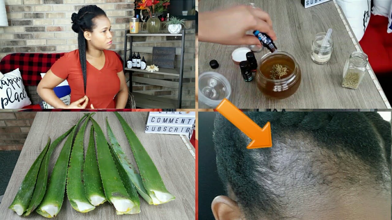 3 ways to use aloe vera oil for massive hair growth | Homemade aloe vera oil/ leave in & butter