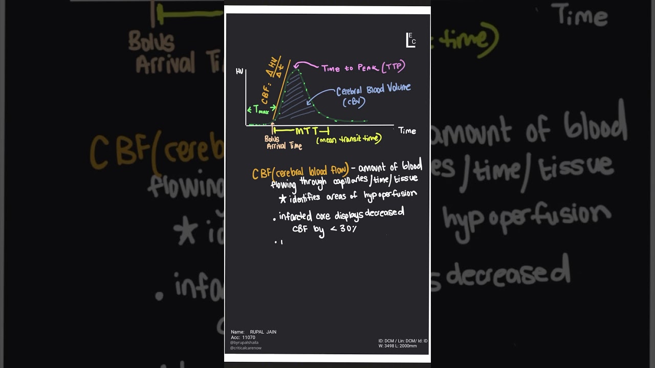 The Rad Review Episode #8. CT Perfusion Confusion