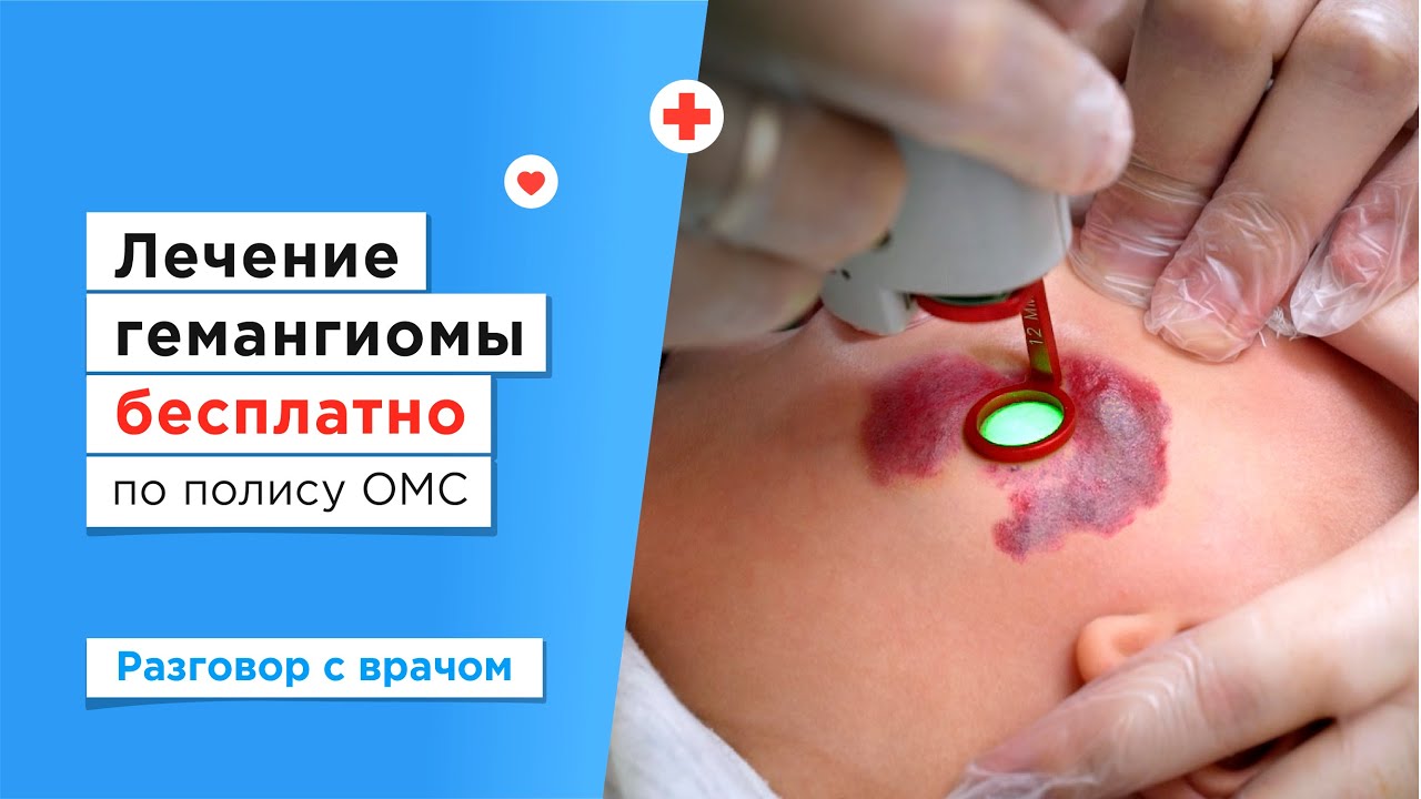 Лазерное удаление гемангиомы у детей бесплатно по полису ОМС