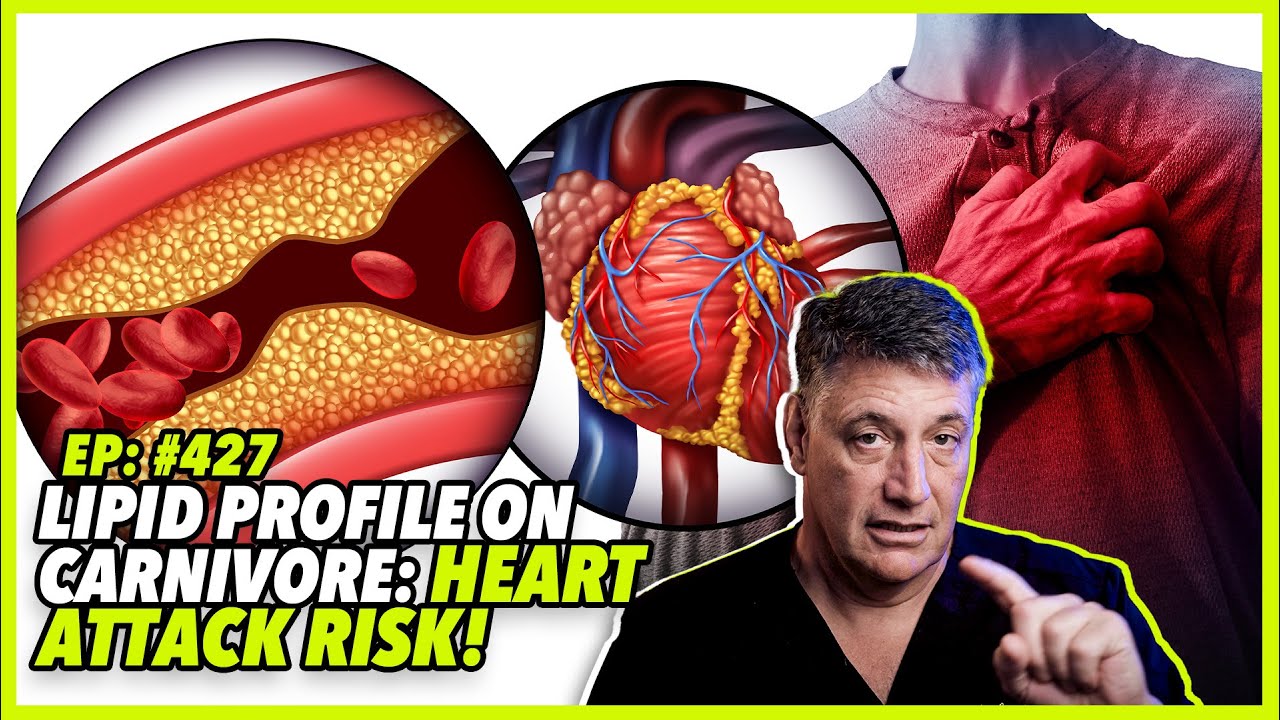 Ep:427 LIPID PROFILE ON CARNIVORE: 🚨🚨 HEART ATTACK RISK! 🚨🚨