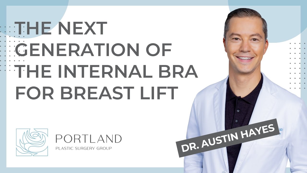 The next generation of the internal bra technique for breast lift surgery #NoBraNoProblem