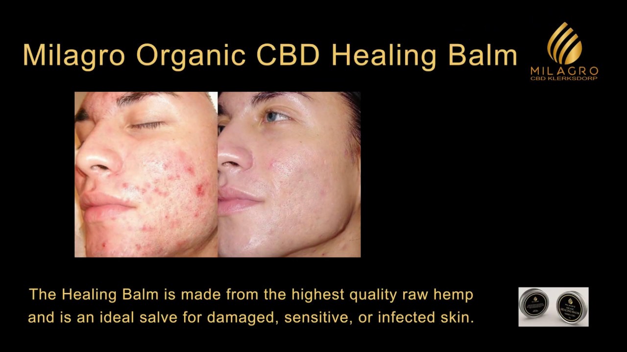 Milagro Organic CBD Healing Balm