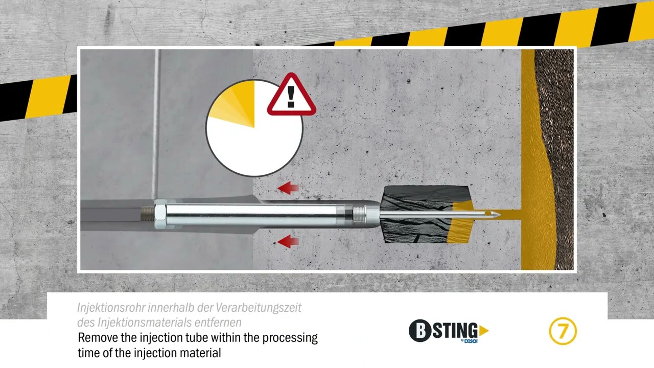 B STING® Fugeninjektionsnadel - Arbeitsschritte; B-STING® joint injection needle - Working steps