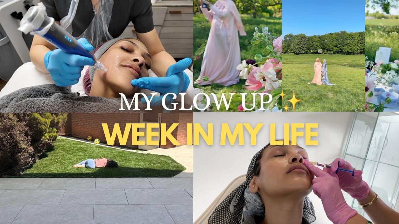 Microneedling, Dark Circles Treatment & Getting My Life Together | Week in My 30s 💅