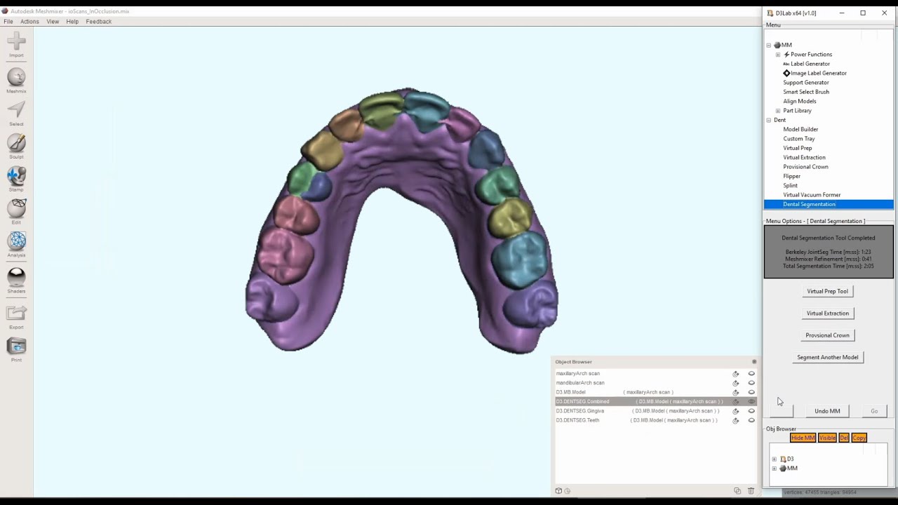 D3Lab x64  -  Dental Segmentation and Post Segmentation Refinement in Meshmixer