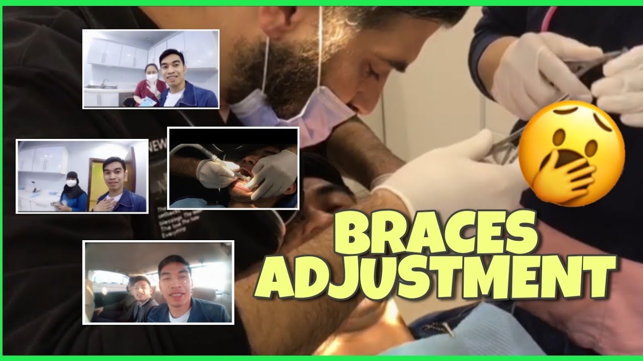 OFW| BRACES ADJUSTMENT for today's vidjuuu! |Armand vlogs tv #bisayatagalogvlog