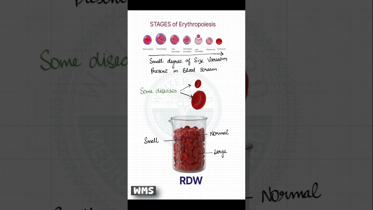 What is RDW Mean in Your CBC?