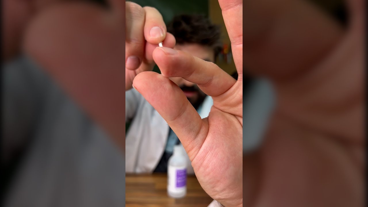 How to get superglue off your skin