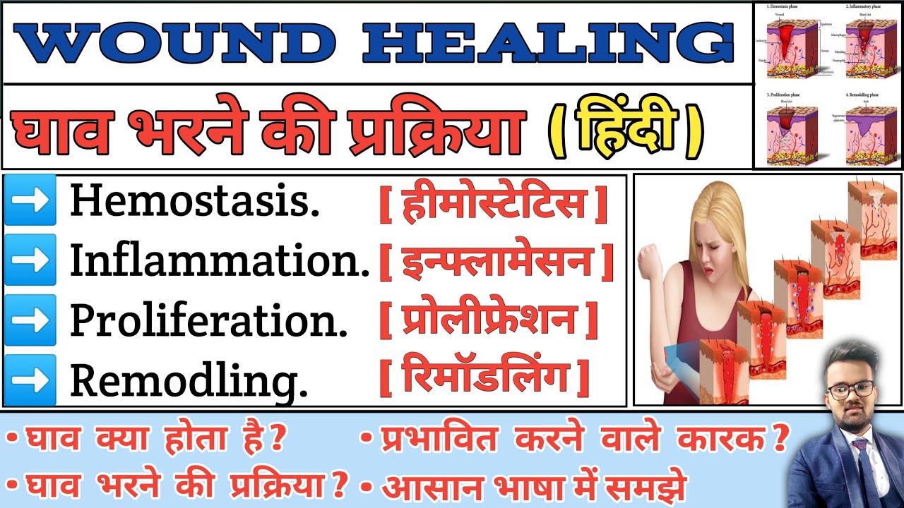 Wound Healing | Wound Healing Pathology | Wound Healing Process | Step of Wound Healing | Pathology