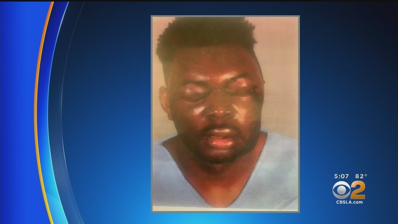 Civil Rights Lawsuit Filed Against LASD After Traffic Stop Ends In Beating