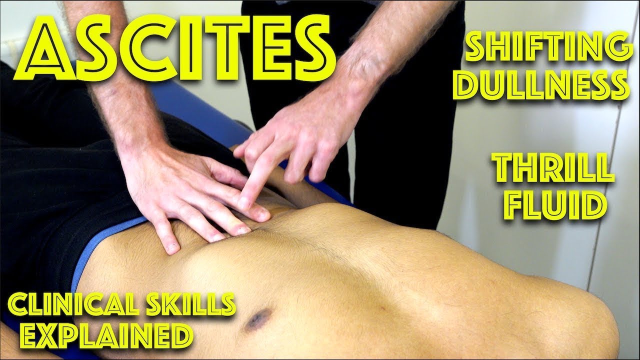 Ascites Examination - Shifting Dullness & Fluid Thrill - Clinical Skills Revision - Dr Gill