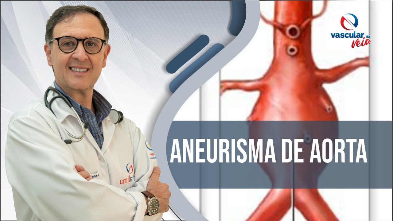 Aneurisma de Aorta