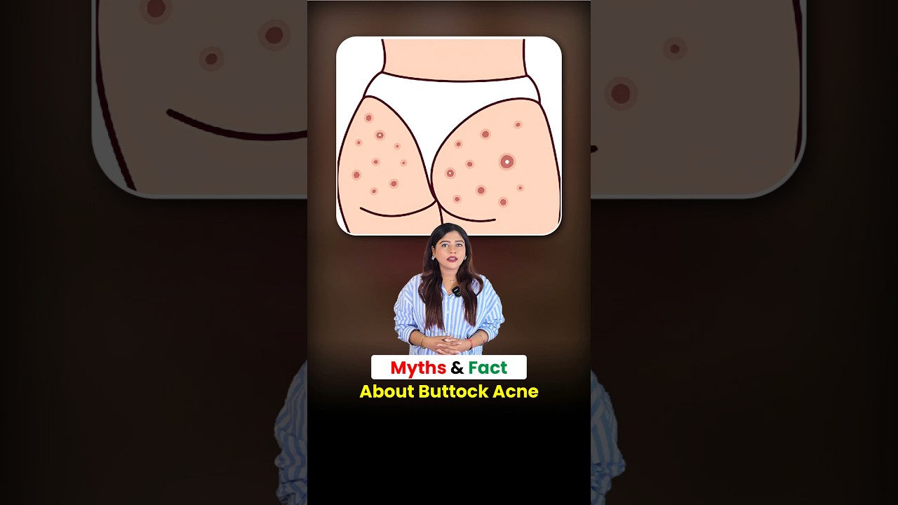 Buttock Acne Myths Busted! 🚫🧴 Sirf Hygiene Se Nahi Hota | Dermatologist Explains
