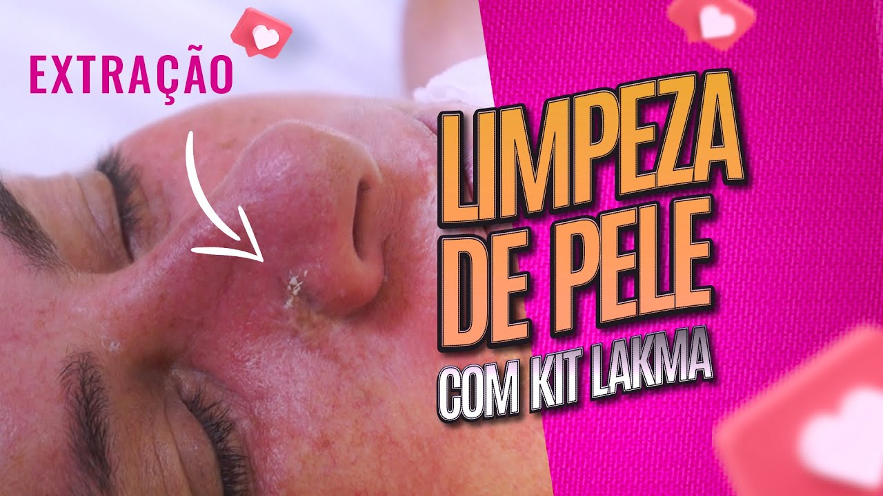 Limpeza de pele completa com kit Lakma (Com extração)