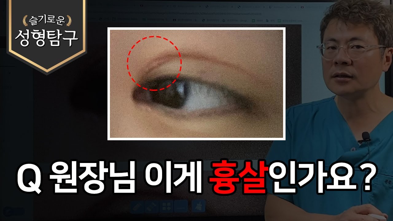 Q. 원장님 이게 흉살인가요?