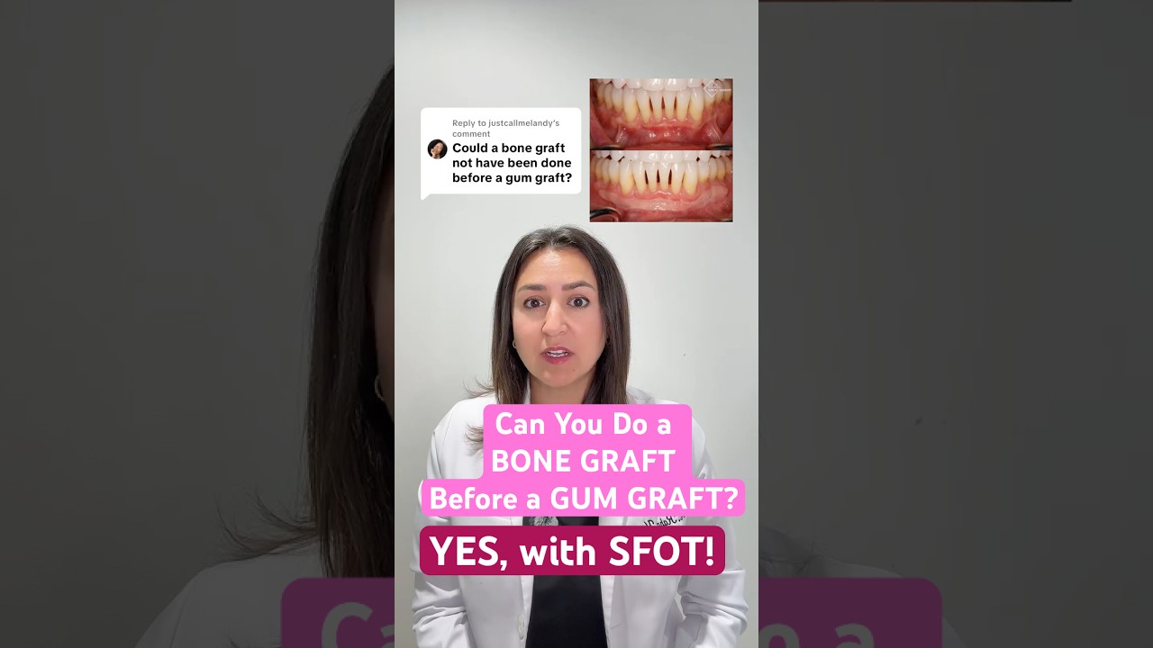 Can a Bone Graft Be Performed Before A Gum Graft?✨ Yes with SFOT!  |  District Dental Surgery