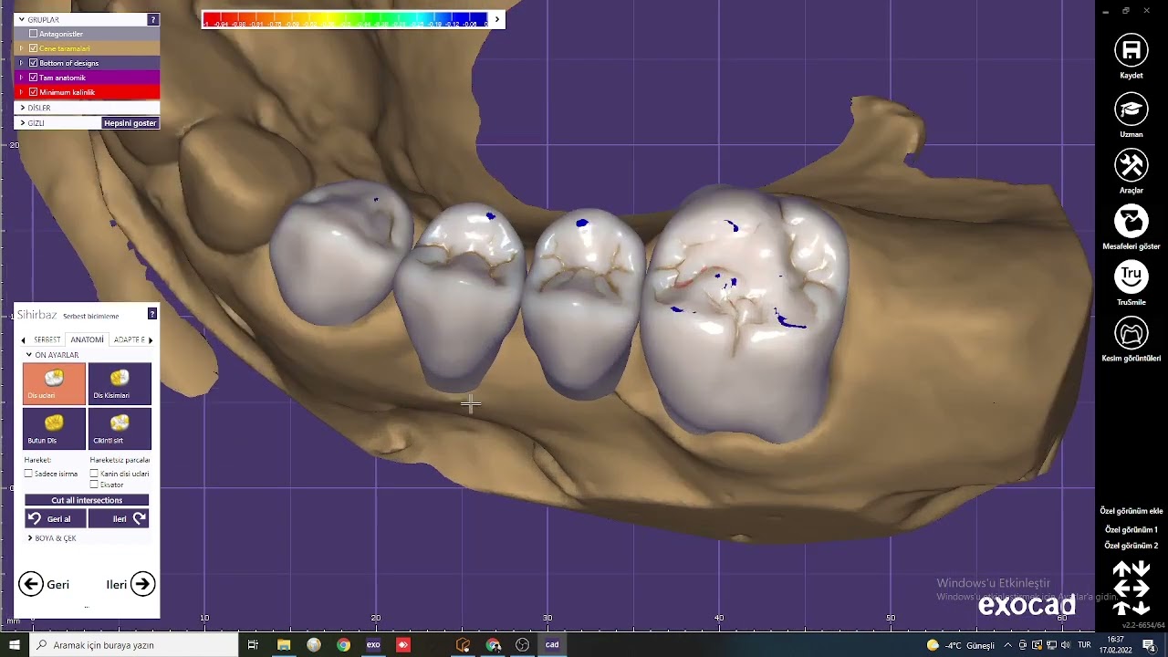 EXOCAD Anatomik köprü Aasarımı