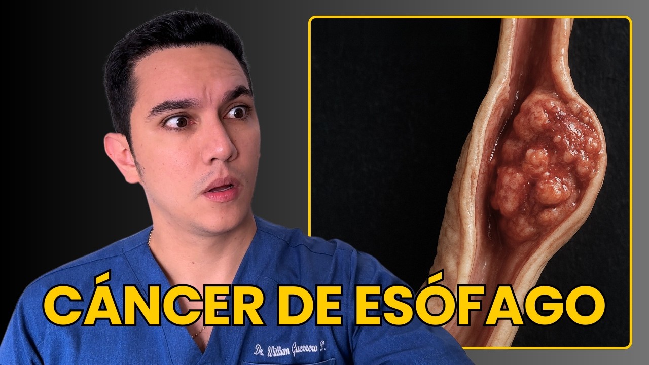 Meses pensando que era solo una infección de garganta, pero era un tumor maligno de esófago avanzado