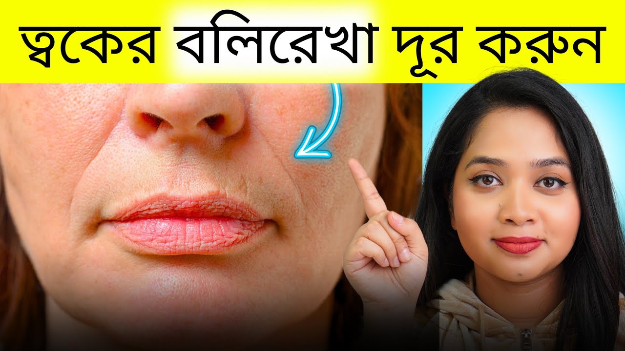 🥕 ন্যাচারালি ত্বকের বলিরেখা দূর করবে যে ৬টি খাবার | 6 Foods To Remove Wrinkles & Fine Lines