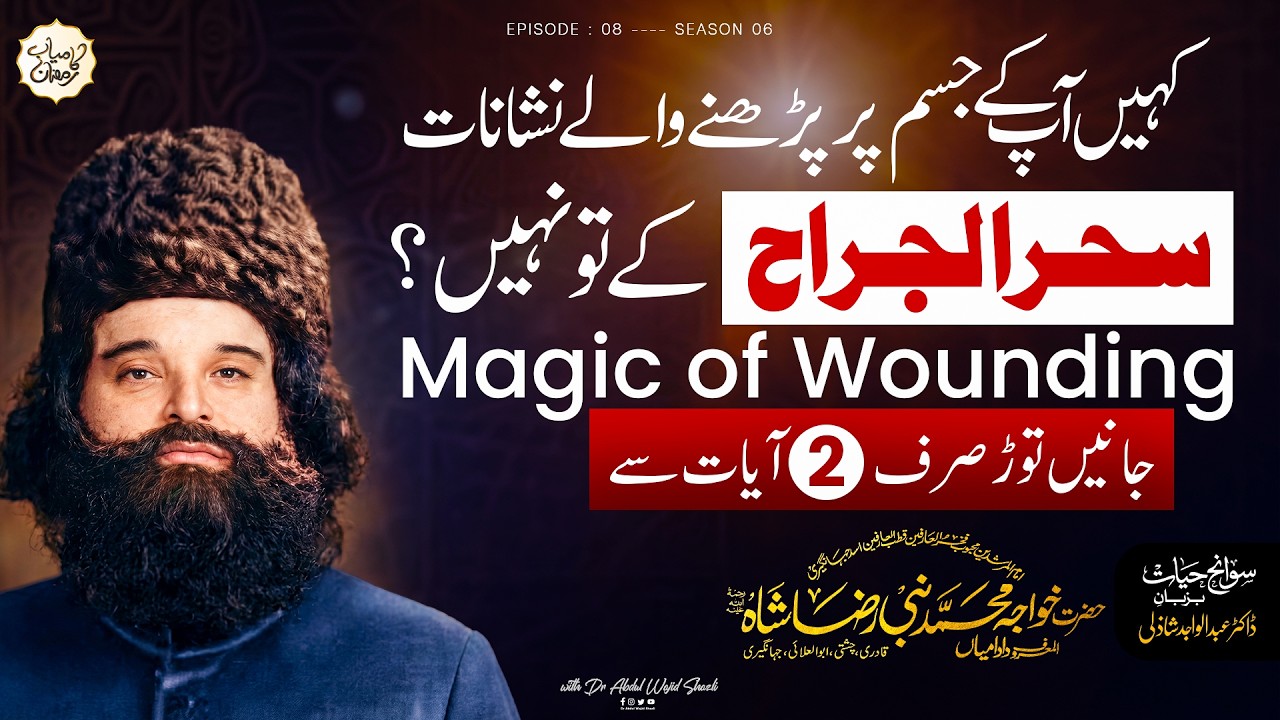 Kahin apke jism per parhne wale nishaan Sehar ul Jarah tow nahi? | Ep 8
