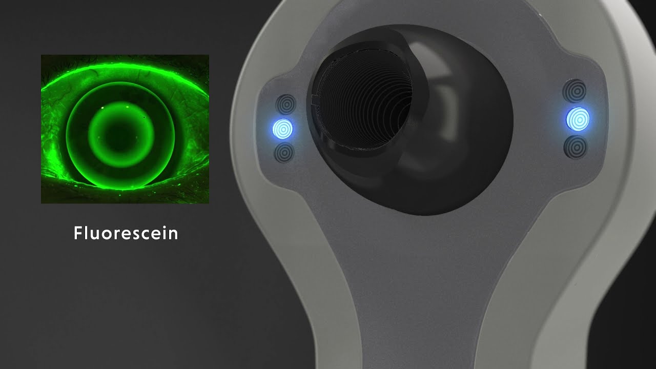 Medmont Meridia | Advanced Corneal Topographer
