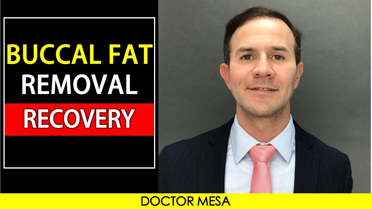 How is the recovery after the Buccal Fat Removal Procedure?  Dr. Mesa Plastic Surgeon Answers