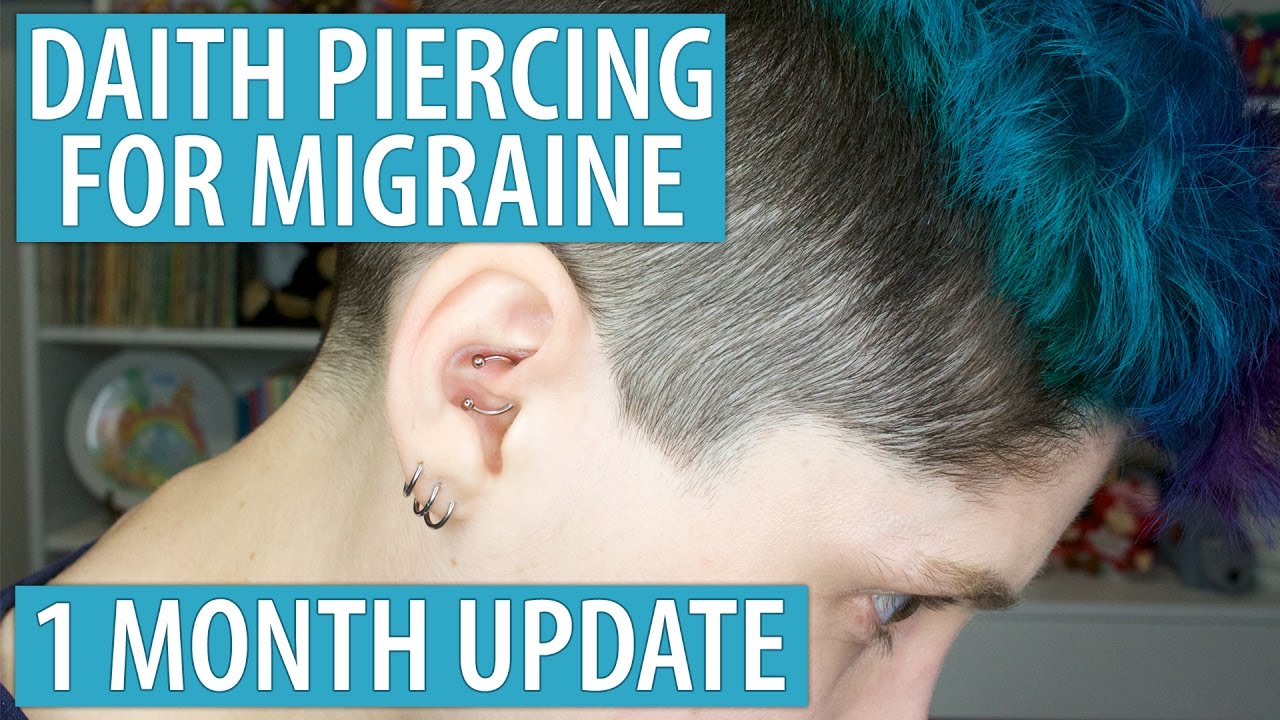 Daith Piercing for Migraine - 1 Month Update