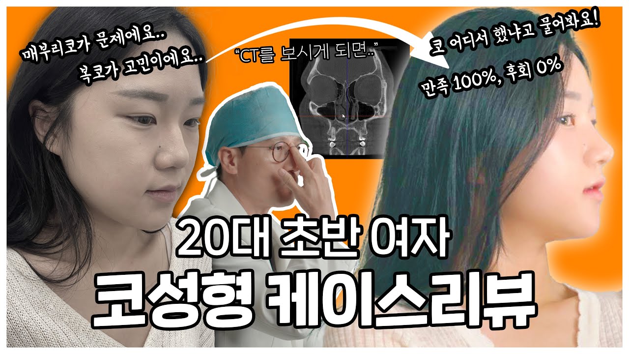 자연스러운 매부리 복코 성형 전후 케이스, 20대 초반 여자 코수술 리뷰 | 코성형 CT영상 有  #매부리코 #복코작아지는법 [첫단추 231204]