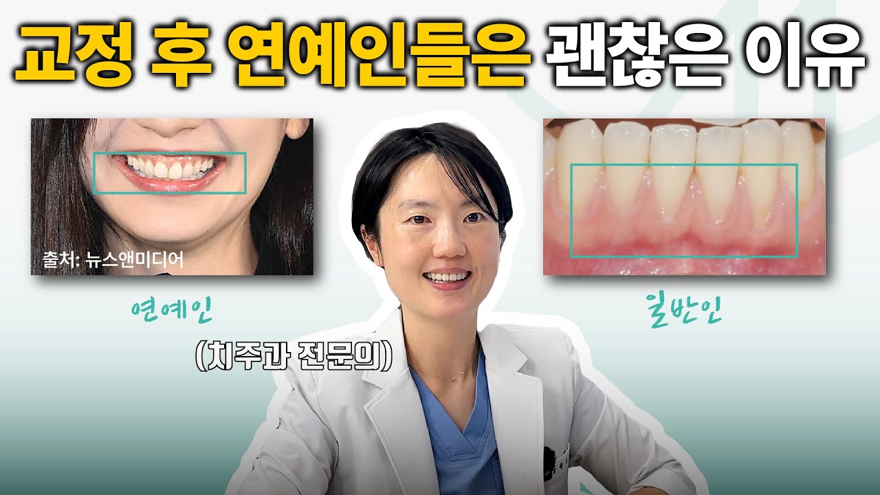 교정 후 걷잡을 수 없이 잇몸이 내려간다면?