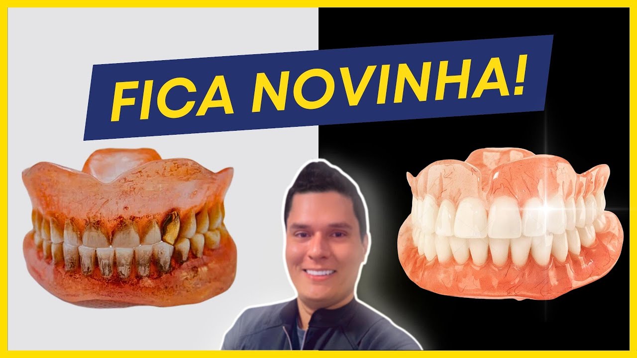 COMO LIMPAR UMA PRÓTESE DENTÁRIA ENCARDIDA? (PASSO A PASSO)