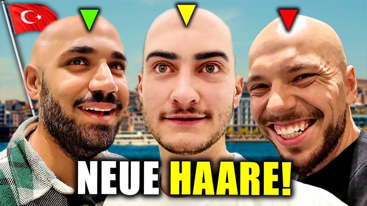 ER WILL NEUE HAARE! HAARTRANSPLANTATION IN DER TÜRKEI