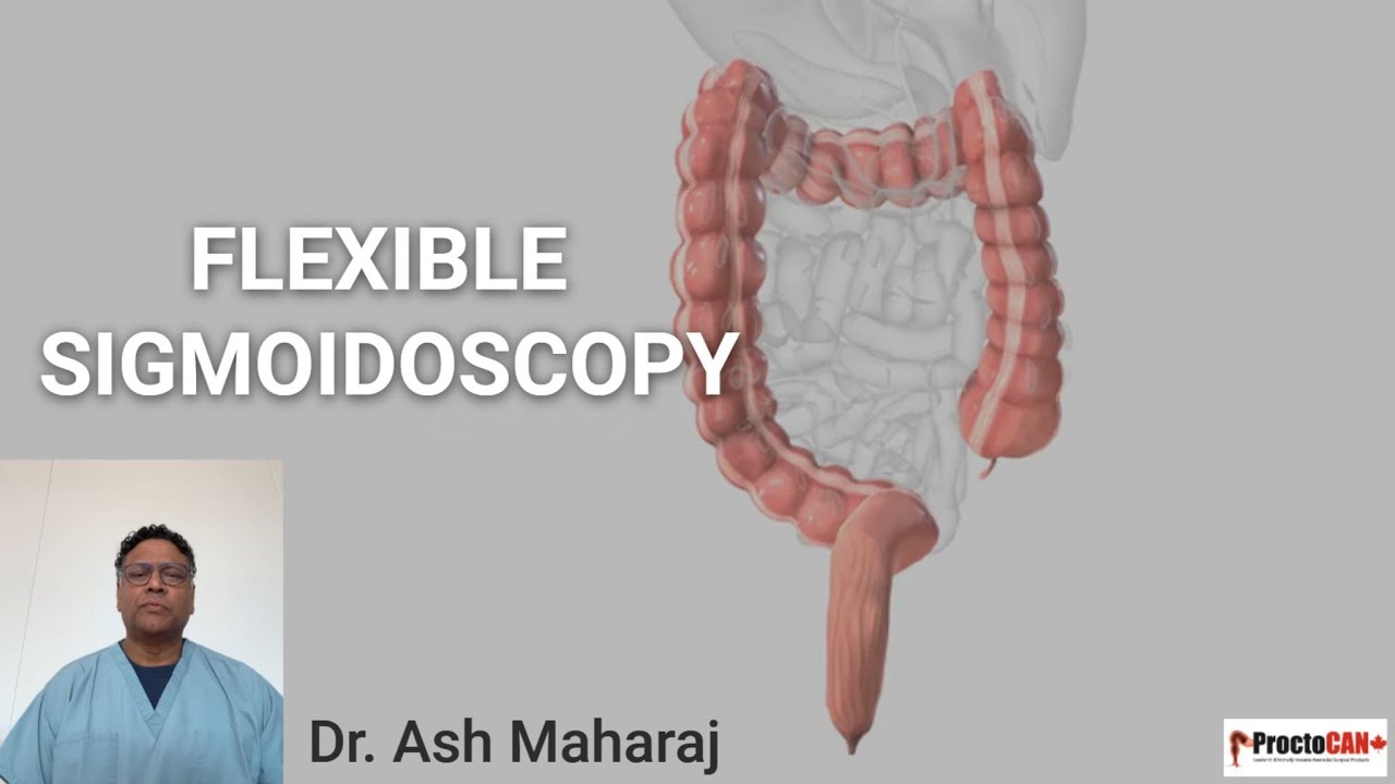 Flexible Sigmoidoscopy