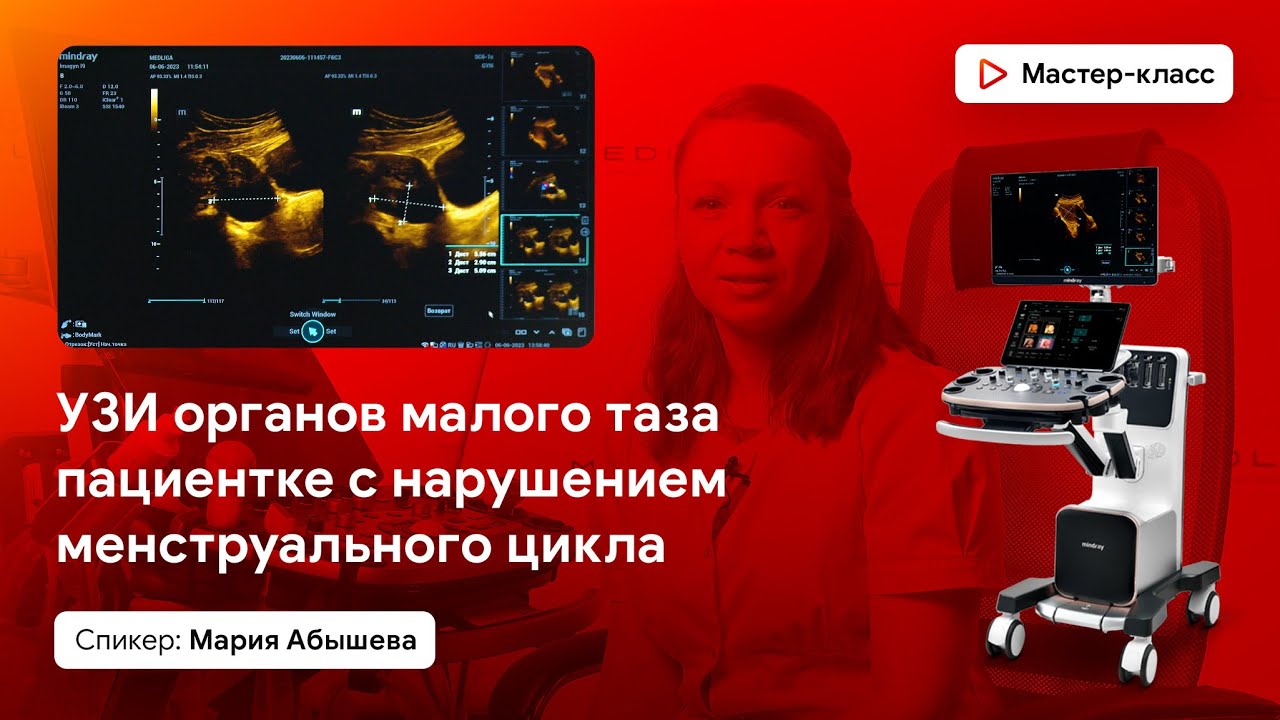 УЗИ органов малого таза пациентке с нарушением менструального цикла на Mindray Imagyn i9