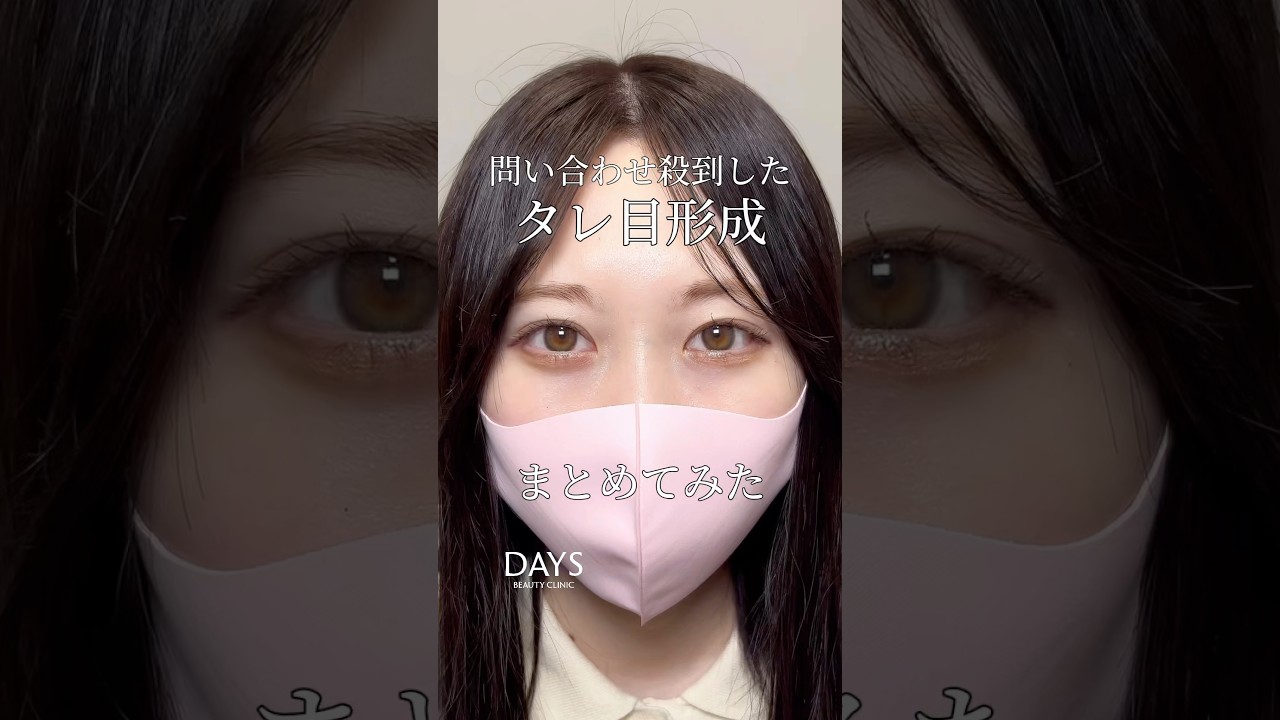 【目元整形】人気のタレ目形成まとめてみました！#shorts