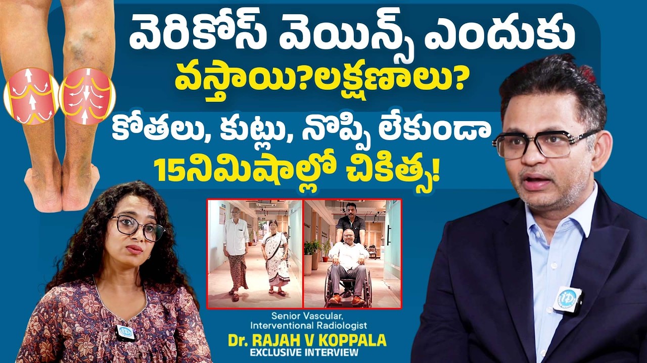 కొత్త, కుట్లు, నొప్పి లేకుండా 15ని.లో వెరికోస్ వెయిన్స్ చికిత్స | Varicose Veins | Dr. Rajah |iDream