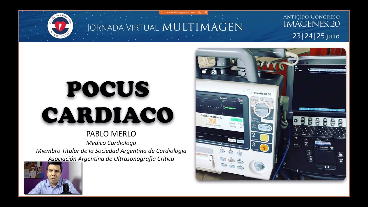 POCUS CARDIACO JORNADAS SAC 2020