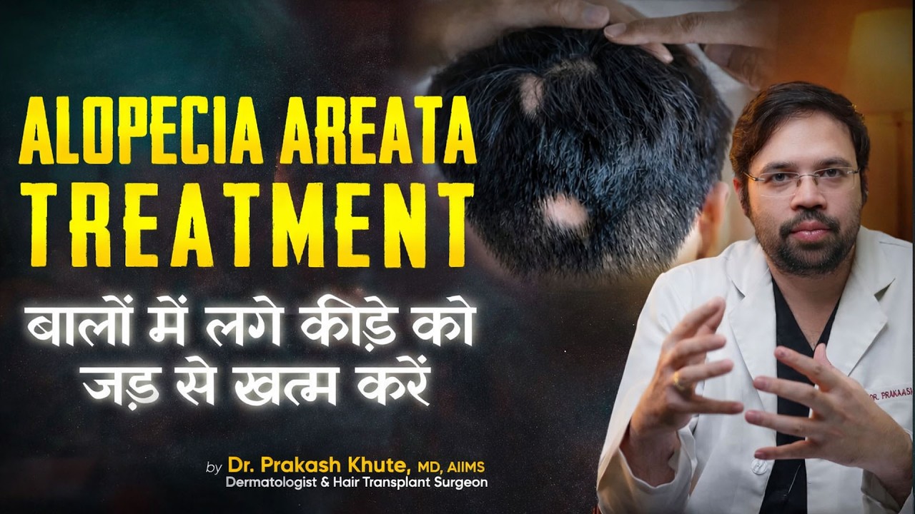 Alopecia Areata Explained: Causes, Symptoms & Best Treatments for Patchy Hair Loss |Skinroots Clinic