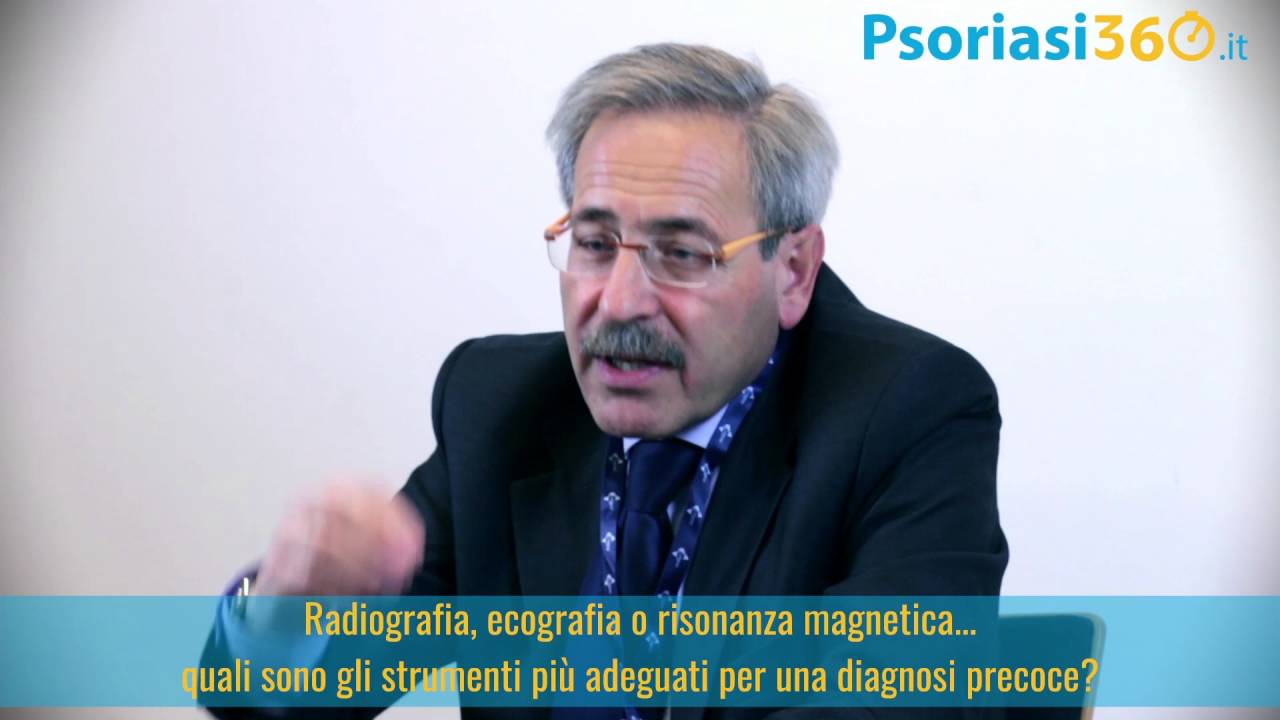 Individuare l'artrite psoriasica: Il ruolo del medico di medicina generale