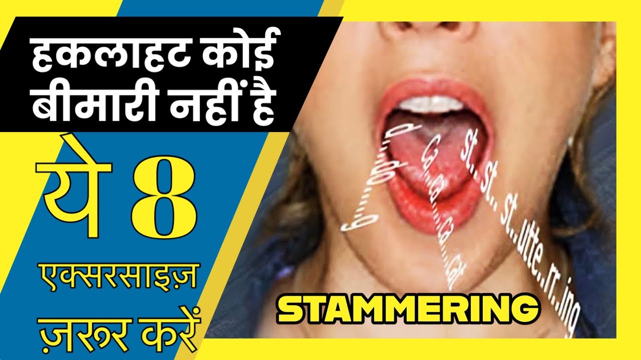 STAMMERING EXERCISES AND SPEECH THERAPY |  हकलाने का इलाज | हकलाहट कैसे दूर करें | STUTTERING CURE